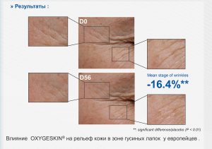 Oxygeskin Насыщение кожи кислородом - oxygeskin ris2 2 - 6